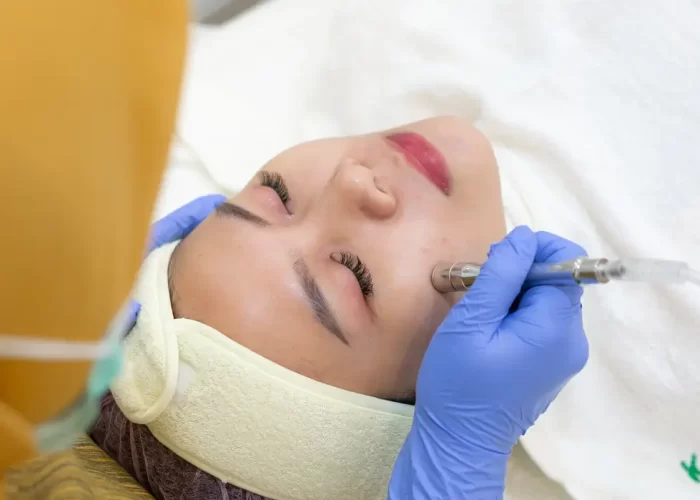 microdermabrasi